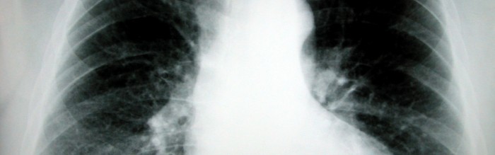 lung x-ray